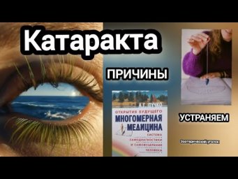 Катаракта.