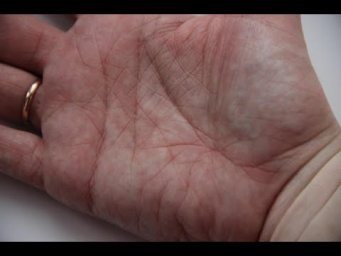 что значат ямы, острова, ветки вниз на моих линиях? хиромантия