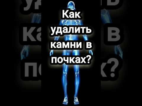Как удалить камни? #камнивпочках #здоровье #пучко #многомернаямедицина #эзотерика Как удалить камни? #камнивпочках #здоровье #пучко #многомернаямедицина #эзотерика